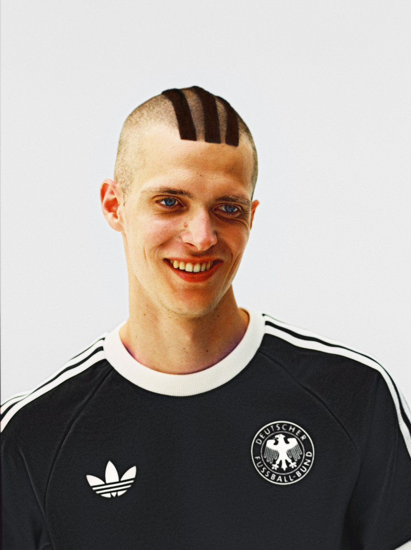 THE BROKEN ARM X ADIDAS EURO24