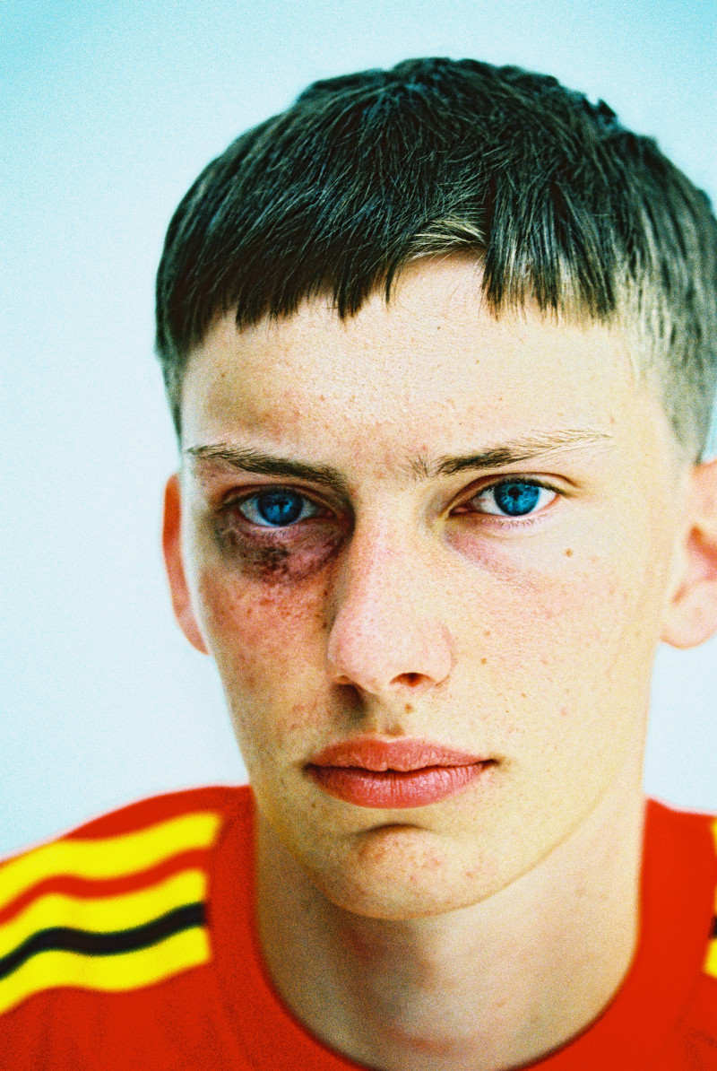 THE BROKEN ARM X ADIDAS EURO24 image-10